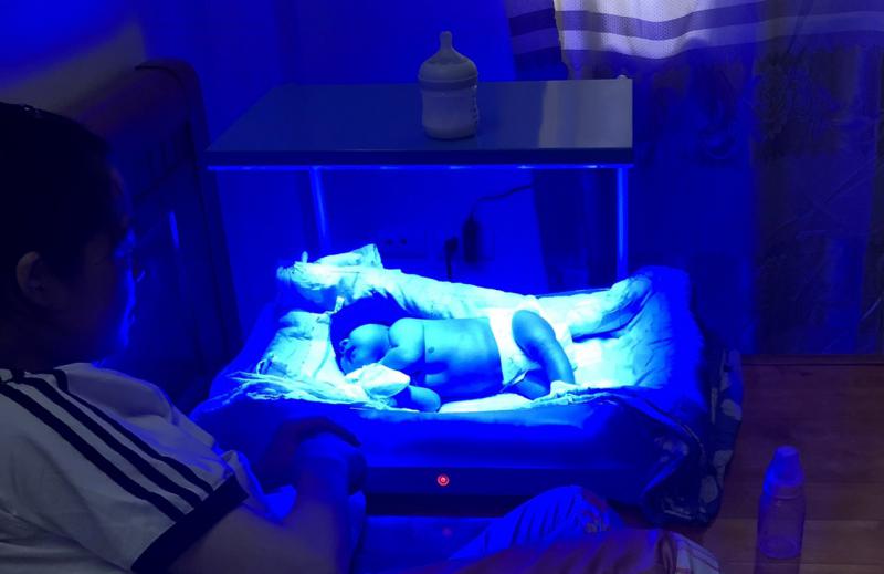 Ba mẹ ngồi cạnh bé đang chiếu đèn vàng da